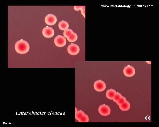 enterobacter cloacae